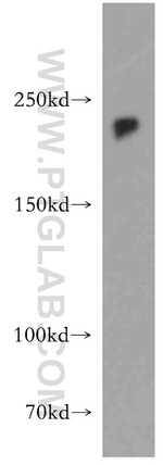 ZEB1 Antibody in Western Blot (WB)