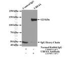 UBE4A Antibody in Immunoprecipitation (IP)