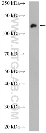 UBE4A Antibody in Western Blot (WB)