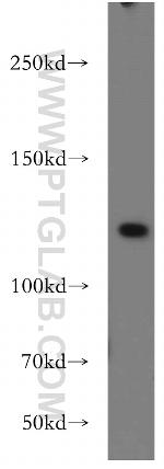 UBE4A Antibody in Western Blot (WB)