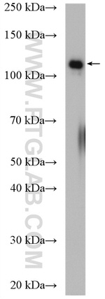 UBE4A Antibody in Western Blot (WB)