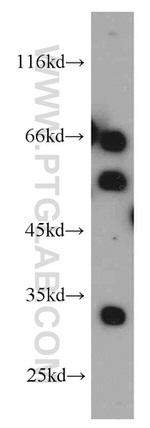 NRBP2 Antibody in Western Blot (WB)