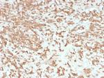 Coagulation Factor VII/F7 Antibody in Immunohistochemistry (Paraffin) (IHC (P))