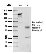 Coagulation Factor VII/F7 Antibody in SDS-PAGE (SDS-PAGE)