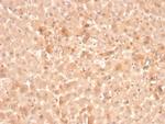 Coagulation Factor VII/F7 Antibody in Immunohistochemistry (Paraffin) (IHC (P))