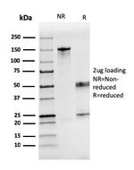 Coagulation Factor VII/F7 Antibody in SDS-PAGE (SDS-PAGE)