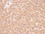 Coagulation Factor VII/F7 Antibody in Immunohistochemistry (Paraffin) (IHC (P))