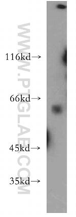 CYP26B1 Antibody in Western Blot (WB)