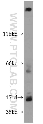 CYP26B1 Antibody in Western Blot (WB)