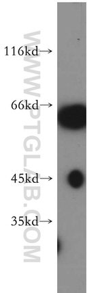 NAGS Antibody in Western Blot (WB)