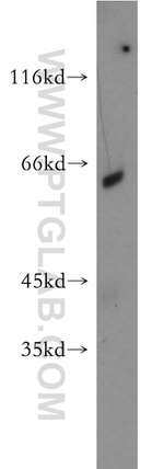 NAGS Antibody in Western Blot (WB)