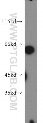 NAGS Antibody in Western Blot (WB)