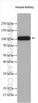 ATP6V0A4 Antibody in Western Blot (WB)