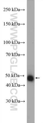 JMJD4 Antibody in Western Blot (WB)