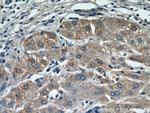 MOGAT1 Antibody in Immunohistochemistry (Paraffin) (IHC (P))