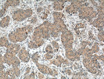 TNFR1 Antibody in Immunohistochemistry (Paraffin) (IHC (P))