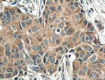 TNFR1 Antibody in Immunohistochemistry (Paraffin) (IHC (P))