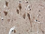 TNFR1 Antibody in Immunohistochemistry (Paraffin) (IHC (P))