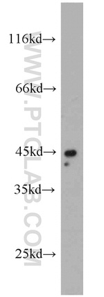 TNFR1 Antibody in Western Blot (WB)