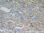 CYP24A1 Antibody in Immunohistochemistry (Paraffin) (IHC (P))