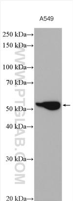 CYP24A1 Antibody in Western Blot (WB)