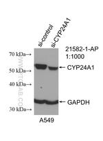 CYP24A1 Antibody in Western Blot (WB)