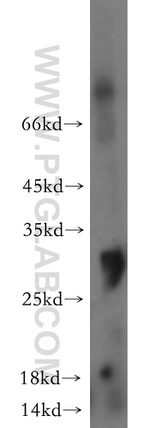 OGFOD2 Antibody in Western Blot (WB)