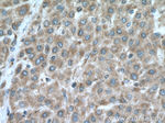 DNA2 Antibody in Immunohistochemistry (Paraffin) (IHC (P))