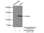 DNA2 Antibody in Immunoprecipitation (IP)