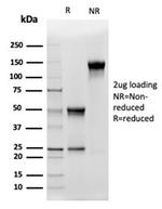 ALDH1A1 (Aldehyde Dehydrogenase 1A1) Antibody in SDS-PAGE (SDS-PAGE)