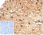 ALDH1A1 (Aldehyde Dehydrogenase 1A1) Antibody in Immunohistochemistry (Paraffin) (IHC (P))