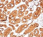 ALDH1A1 (Aldehyde Dehydrogenase 1A1) Antibody in Immunohistochemistry (Paraffin) (IHC (P))