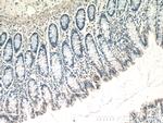 TTC7A Antibody in Immunohistochemistry (Paraffin) (IHC (P))