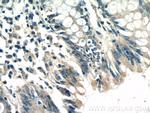 TTC7A Antibody in Immunohistochemistry (Paraffin) (IHC (P))