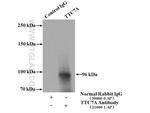 TTC7A Antibody in Immunoprecipitation (IP)