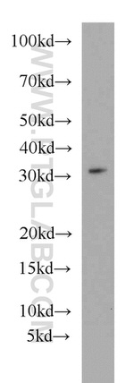 MRPL28 Antibody in Western Blot (WB)