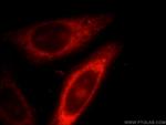 IL1RAPL1 Antibody in Immunocytochemistry (ICC/IF)