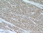 IL1RAPL1 Antibody in Immunohistochemistry (Paraffin) (IHC (P))