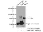 IL1RAPL1 Antibody in Immunoprecipitation (IP)