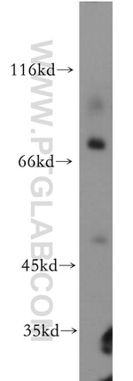 IL1RAPL1 Antibody in Western Blot (WB)