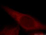 MAP3K4 Antibody in Immunocytochemistry (ICC/IF)