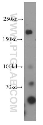 MAP3K4 Antibody in Western Blot (WB)