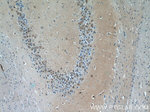 PFTK1 Antibody in Immunohistochemistry (Paraffin) (IHC (P))