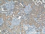 PFTK1 Antibody in Immunohistochemistry (Paraffin) (IHC (P))