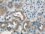 PFTK1 Antibody in Immunohistochemistry (Paraffin) (IHC (P))