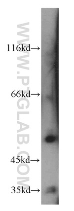 PFTK1 Antibody in Western Blot (WB)