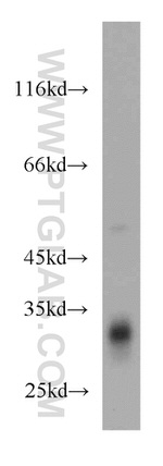 FHL2 Antibody in Western Blot (WB)