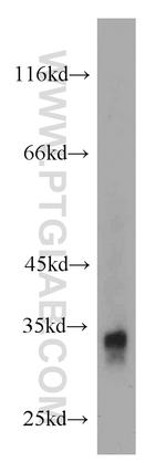 FHL2 Antibody in Western Blot (WB)