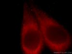 TMED9 Antibody in Immunocytochemistry (ICC/IF)