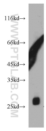 TMED9 Antibody in Western Blot (WB)